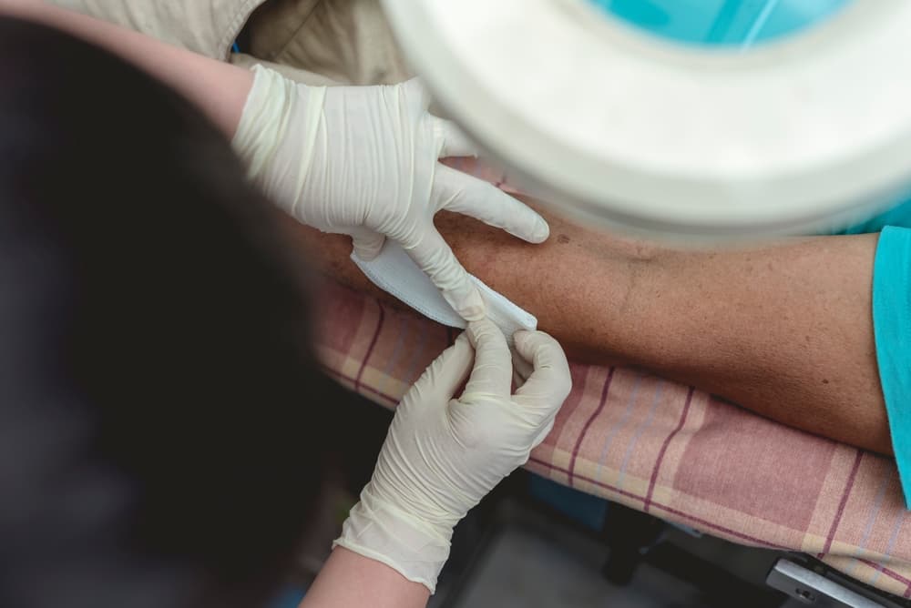 Dressing a disinfected dog bite wound on a patient's forearm at a bite center or local clinic for proper care and healing.